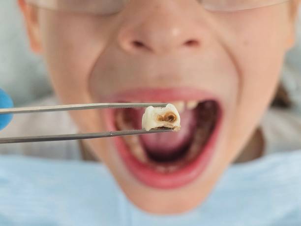 Best Emergency Cosmetic Dentistry (e.g., broken veneers) in New Lexington, OH