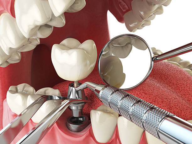 Best Emergency Care for Gum Disease in New Lexington, OH